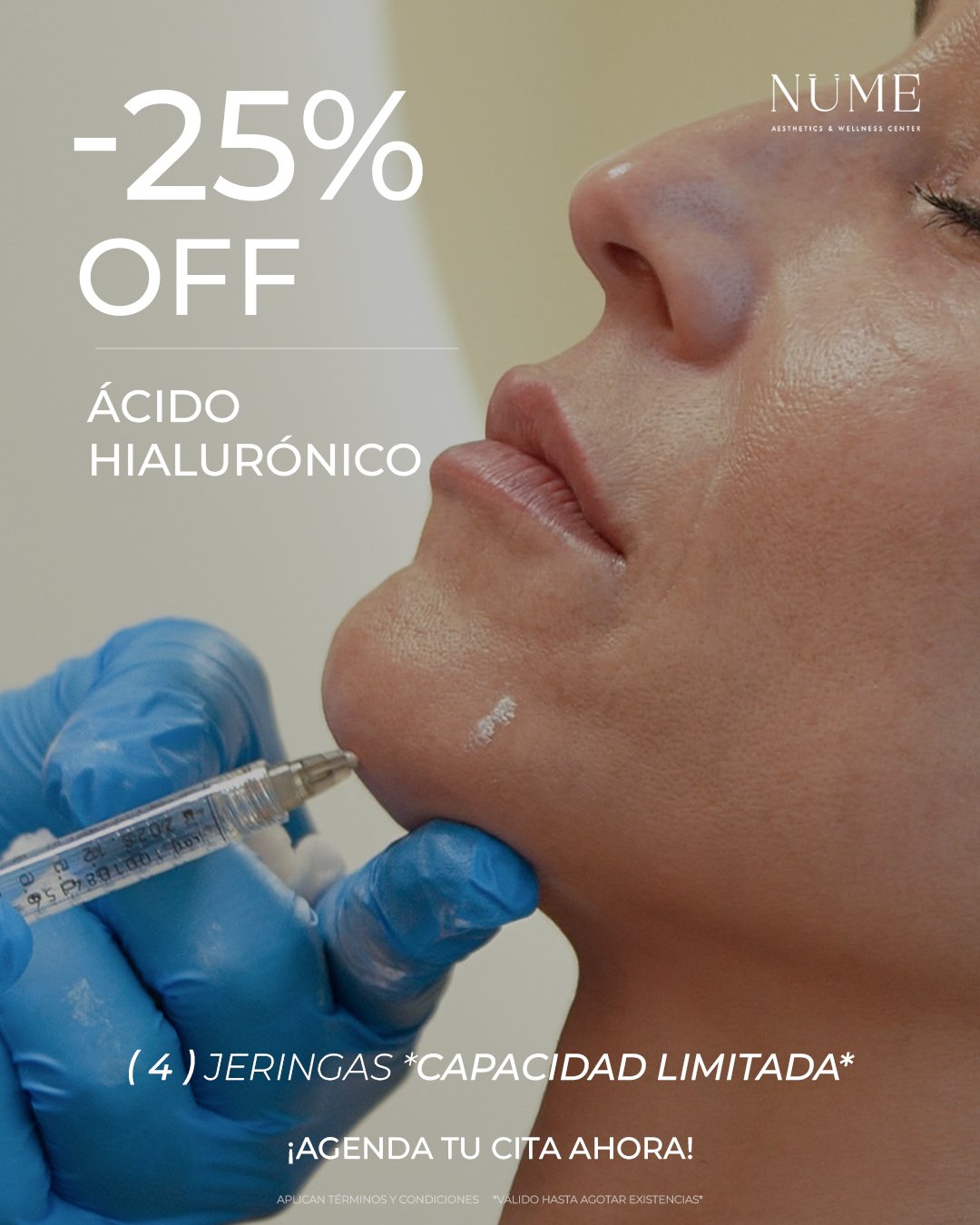 Promocion acido hialuronico 25 por ciento descuento en NuMe Cancun