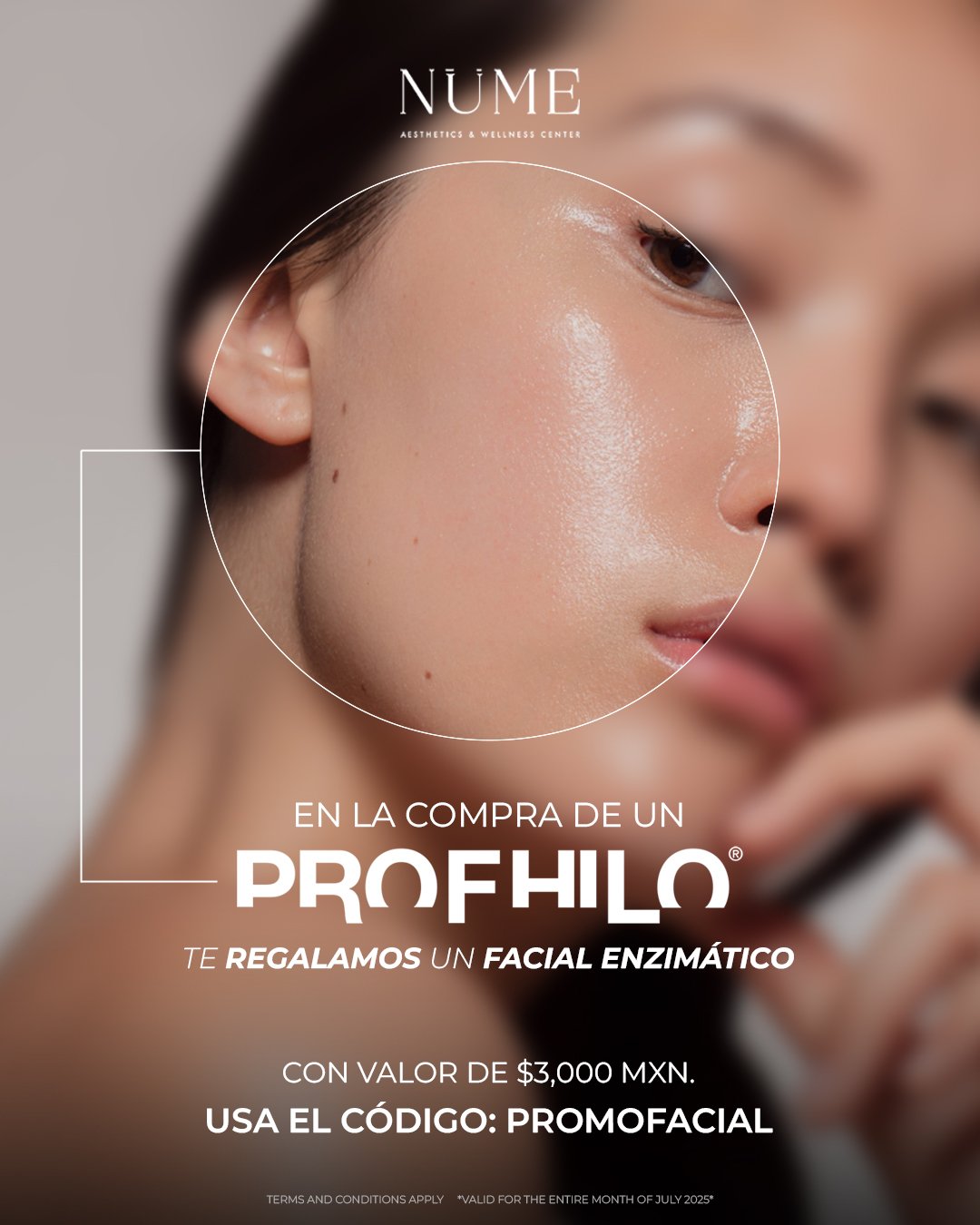 Promocion Profhilo remodelacion de piel en NuMe Cancun